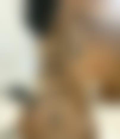 #anal